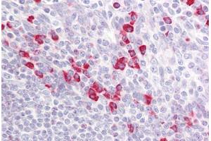 Anti-PAK1/2/3 antibody IHC staining of human tonsil. (PAK1/2/3 Antikörper  (AA 391-440))