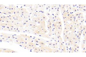 Detection of CFL2 in Human Cardiac Muscle Tissue using Polyclonal Antibody to Cofilin 2, Muscle (CFL2) (Cofilin 2 Antikörper  (AA 1-156))