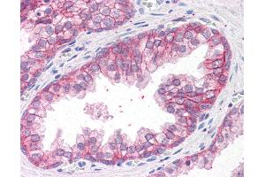 Anti-CTNNA1 antibody IHC of human prostate. (CTNNA1 Antikörper  (AA 871-883))
