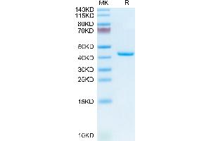 Mouse TNFRSF12A on Tris-Bis PAGE under reduced condition. (TNFRSF12A Protein (AA 28-80) (Fc Tag))