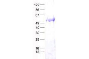 TRMT5 Protein (His tag)