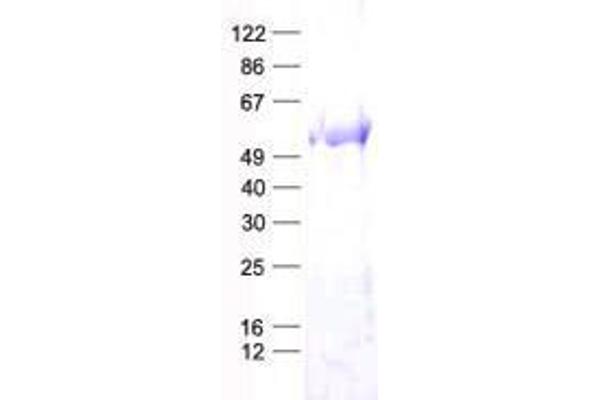 TRMT5 Protein (His tag)