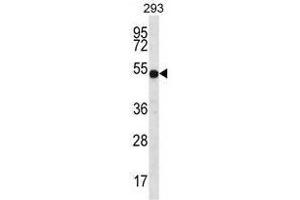 Western Blotting (WB) image for anti-ATPase, H+ Transporting, Lysosomal 56/58kDa, V1 Subunit B1 (ATP6V1B1) (AA 471-501), (C-Term) antibody (ABIN950570)