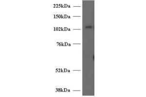 Image no. 1 for anti-Unc-13 Homolog D (UNC13D) (Internal Region) antibody (ABIN374716) (UNC13D Antikörper  (Internal Region))