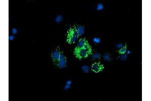 Anti-DLD mouse monoclonal antibody (ABIN2454952) immunofluorescent staining of COS7 cells transiently transfected by pCMV6-ENTRY DLD (RC200639). (DLD Antikörper)
