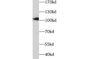Western blot analysis of rat liver tissue subjected to SDS-PAGE, using SARDH antibody (1/1000 dilution). (SARDH Antikörper)