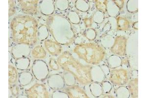 Immunohistochemistry of paraffin-embedded human kidney tissue using ABIN7173734 at dilution of 1:100