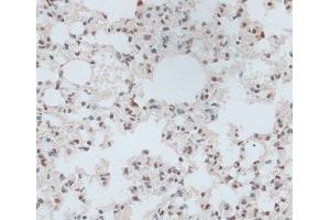 Immunohistochemistry of paraffin-embedded Mouse lung using ZNF416 Polyclonal Antibody at dilution of 1:100 (40x lens).