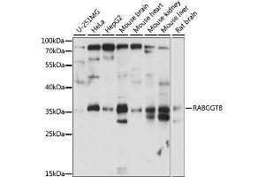 Western blot analysis of extracts of various cell lines, using RABGGTB antibody (ABIN7269784) at 1:1000 dilution. (RABGGTB Antikörper  (AA 1-331))