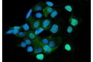 anti-3-Hydroxy-3-Methylglutaryl-CoA Synthase 1 (Soluble) (HMGCS1) (AA 251-520) antibody