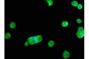 Immunofluorescence staining of MCF-7 cells with ABIN7168018 at 1:100, counter-stained with DAPI. (RHOB Antikörper  (AA 1-196))