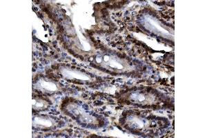 IHC analysis of HIF-1 alpha/HIF1A using anti-HIF-1 alpha/HIF1A antibody (ABIN7602159).
