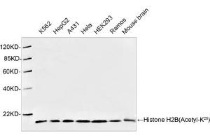 Western blot analysis of cell and tissue lysates using 1 µg/mL Antibodies-Online Rabbit Anti-Histone H2B (Acetyl-K20) Polyclonal Antibody (ABIN398911) The signal was developed with IRDyeTM 800 Conjugated Goat Anti-Rabbit IgG. (Histone H2B Antikörper  (Lys20))