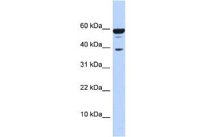 WB Suggested Anti-PPP1R8 Antibody Titration:  0. (PPP1R8 Antikörper  (Middle Region))