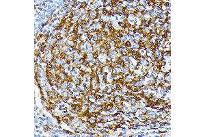 Immunohistochemistry of paraffin-embedded human tonsil using Casein Kinase 1 alpha (Casein Kinase 1 alpha (CSNK1)) antibody (6225) at dilution of 1:100 (40x lens). (CSNK1A1 Antikörper  (AA 100-200))