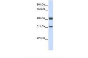Image no. 1 for anti-Prenyl (Decaprenyl) Diphosphate Synthase, Subunit 2 (PDSS2) (C-Term) antibody (ABIN6739233)