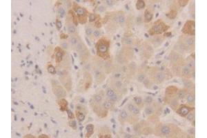 DAB staining on IHC-P; Samples: Human Liver Tissue (NEU1 Antikörper  (AA 47-415))