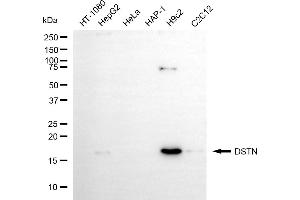 Western blotting analysis using DSTN antibody (ABIN7798322).