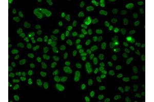 Immunofluorescence analysis of A549 cell using PLCXD2 antibody. (PLCXD2 Antikörper)