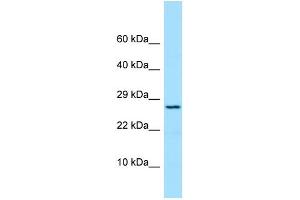 Host: Rabbit Target Name: PRDX4 Sample Type: COLO205 Whole Cell lysates Antibody Dilution: 1. (Peroxiredoxin 4 Antikörper  (N-Term))