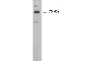 Immunodetection of PAD type 1 using PADI1 antibody in Human epedermis as a 70 kDa protein.