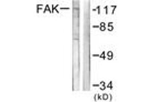 Western blot analysis of extracts from NIH-3T3 cells, using FAK (Ab-576) Antibody. (FAK Antikörper  (AA 542-591))