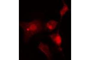 ABIN6275897 staining  Hela cells by IF/ICC. (INA Antikörper  (Internal Region))