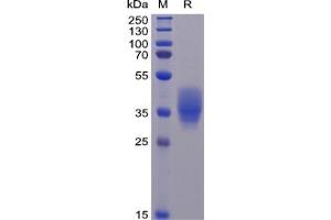Human CD200 Protein, His Tag on SDS-PAGE under reducing condition.