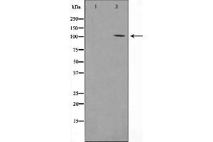Western blot analysis on COLO205 cell lysate using PSMD2 Antibody，The lane on the left is treated with the antigen-specific peptide. (PSMD2 Antikörper  (Internal Region))