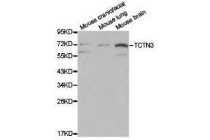 Western Blotting (WB) image for anti-Tectonic Family Member 3 (TCTN3) antibody (ABIN1875046) (TCTN3 Antikörper)