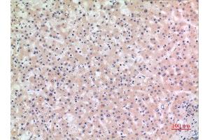 Immunohistochemistry (IHC) image for anti-NLR Family, Pyrin Domain Containing 3 (NLRP3) (Internal Region) antibody (ABIN6287297)