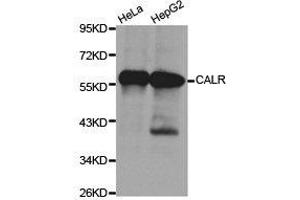 Western Blotting (WB) image for anti-Calreticulin (CALR) antibody (ABIN1871404) (Calreticulin Antikörper)