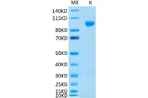 Human MMP-9 on Tris-Bis PAGE under reduced condition. (MMP 9 Protein (His-Avi Tag))