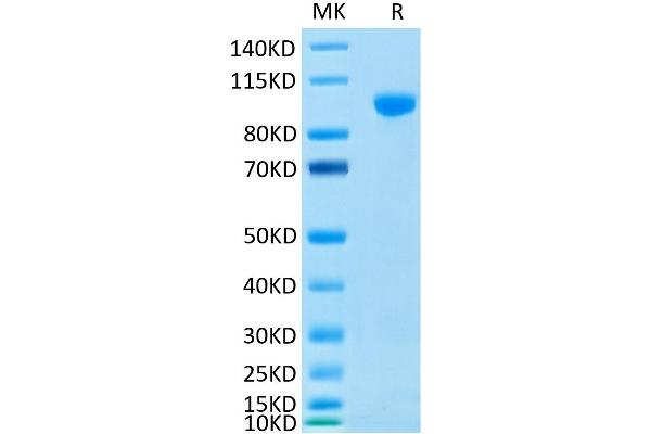 MMP 9 Protein (His-Avi Tag)