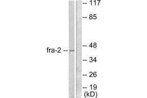 Western Blotting (WB) image for anti-FOS-Like Antigen 2 (FOSL2) (C-Term) antibody (ABIN1848552) (FOSL2 Antikörper  (C-Term))