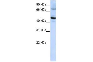 CYP46A1 antibody used at 1 ug/ml to detect target protein. (CYP46A1 Antikörper  (C-Term))
