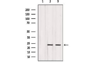 Western blot analysis of extracts from various samples, using LCN2 Antibody. (Lipocalin 2 Antikörper  (Internal Region))