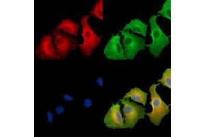 ABIN6263527 and ABIN6279597 staining  cells by IF/ICC.