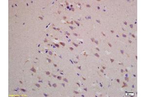 Formalin-fixed and paraffin embedded rat brain labeled with Rabbit Anti BACE1/ASP2 Polyclonal Antibody, Unconjugated (ABIN725705) at 1:200 followed by conjugation to the secondary antibody and DAB staining (BACE1 Antikörper  (AA 401-501))