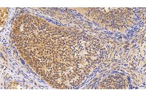 Detection of Surv in Human Ovary Tissue using Monoclonal Antibody to Survivin (Surv) (Survivin Antikörper  (AA 1-142))