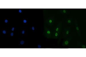 IF analysis of TRBP/TARBP2 using anti-TRBP/TARBP2 antibody (ABIN7600548). (TARBP2 Antikörper  (AA 20-366))