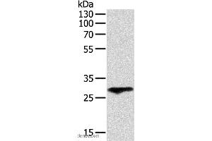 Western blot analysis of Human fetal lung tissue, using F3 Polyclonal Antibody at dilution of 1:400 (Tissue factor Antikörper)
