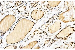 IHC analysis of SPHK1 using anti-SPHK1 antibody (ABIN7600168). (SPHK1 Antikörper  (AA 16-267))