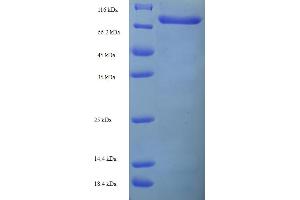 SDS-PAGE (SDS) image for Tripartite Motif Containing 21 (TRIM21) (AA 1-470), (full length) protein (His-SUMO Tag) (ABIN5711419) (TRIM21 Protein (AA 1-470, full length) (His-SUMO Tag))
