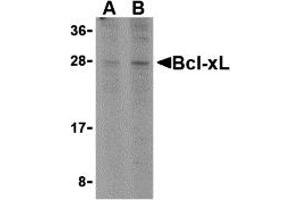Western Blotting (WB) image for anti-BCL2-Like 1 (BCL2L1) (C-Term) antibody (ABIN1030287) (BCL2L1 Antikörper  (C-Term))