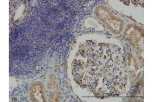Image no. 1 for anti-Cartilage Associated Protein (CRTAP) (AA 307-402) antibody (ABIN466169) (CRTAP Antikörper  (AA 307-402))