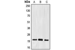 Western blot analysis of Ephrin A2 expression in HepG2 (A), mouse liver (B), rat kidney (C) whole cell lysates.