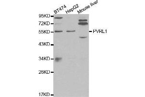 Western blot analysis of extracts of various cell lines, using PVRL1 antibody. (PVRL1 Antikörper)