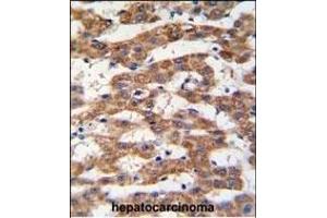 Immunohistochemistry (Paraffin-embedded Sections) (IHC (p)) image for anti-Prohibitin (PHB) (AA 89-117) antibody (ABIN389162)