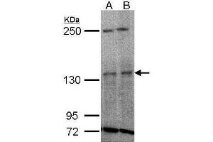 WB Image Sample(30 ug whole cell lysate) A:H1299 B:HeLa S3, 5% SDS PAGE antibody diluted at 1:1000 (TYK2 Antikörper)